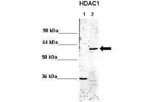 WB Suggested Anti-HDAC1 Antibody  Positive Control: Lane 1: 5ug mouse brain cytoplasm Lane 2: 5ug mouse brain nucleus  Primary Antibody Dilution :  1:1000 Secondary Antibody : Anti rabbit - IR-dye Secondry Antibody Dilution :  1:10,000  Submitted by: Anonymous (HDAC1 antibody  (C-Term))