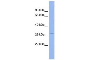 MSI2 antibody used at 1 ug/ml to detect target protein. (MSI2 antibody)