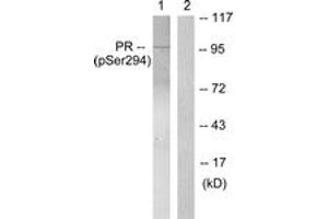Western blot analysis of extracts from 293 cells treated with Etoposide 25uM 60', using Progesterone Receptor (Phospho-Ser294) Antibody. (Progesterone Receptor antibody  (pSer294))