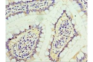 Immunohistochemistry (IHC) image for anti-Interferon gamma Receptor 1 (IFNGR1) (AA 270-489) antibody (ABIN7156601)