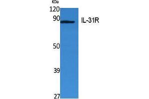 Western Blotting (WB) image for anti-Interleukin 31 Receptor A (IL31RA) (Internal Region) antibody (ABIN3180977) (IL31RA antibody  (Internal Region))