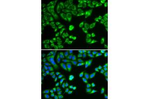 Immunofluorescence analysis of HeLa cells using SH2B1 antibody.