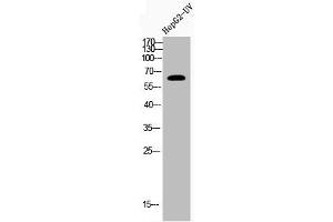 Western Blot analysis of HEPG2-UV cells using Acetyl-NFκB-p65 (K221) Polyclonal Antibody
