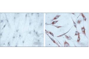Immunohistochemistry of human skin fibroblasts (Left: control, Right: 24 hours after 7th passage of senescence). (HSPD1 antibody)