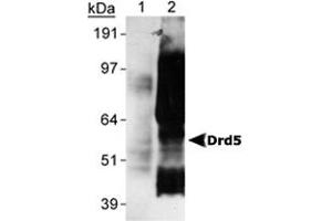 Detection of Drd5 of Sf9 cells transfected with rat Drd5 using Drd5 monoclonal antibody, clone SG4-D1b . (DRD5 antibody  (C-Term))