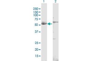 Western Blot analysis of CYP51A1 expression in transfected 293T cell line by CYP51A1 MaxPab polyclonal antibody. (CYP51A1 antibody  (AA 1-509))