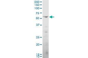 Western Blotting (WB) image for anti-Polynucleotide Kinase 3'-Phosphatase (PNKP) (AA 422-521) antibody (ABIN564910)