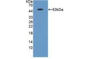 Detection of Recombinant MASP1, Mouse using Polyclonal Antibody to Mannose Associated Serine Protease 1 (MASP1) (MASP1 antibody  (AA 25-453))
