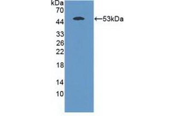 MASP1 抗体  (AA 25-453)