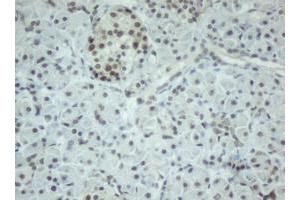 Image no. 2 for anti-Chromobox Homolog 8 (CBX8) (AA 1-260) antibody (ABIN1490663) (CBX8 antibody  (AA 1-260))