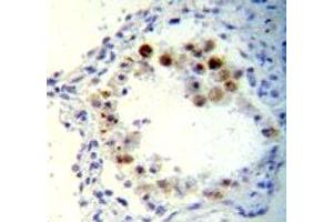 anti-Cyclin-Dependent Kinase Inhibitor 2B (p15, Inhibits CDK4) (CDKN2B) (AA 102-130) antibody