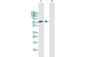 Western Blotting (WB) image for anti-CD209 (CD209) (AA 1-404) antibody (ABIN526278)