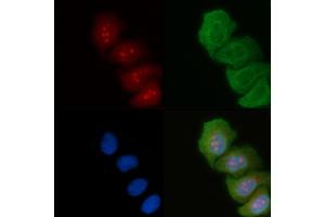 ABIN6264187 and ABIN6274036 staining Hela cells(45 min of heat-shock) by IF/ICC. (PIK3R2 antibody  (C-Term))