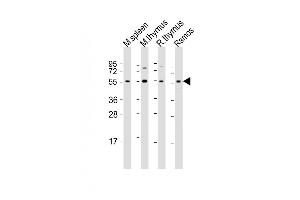 All lanes : Anti-Lck Antibody (Center) at 1:2000 dilution Lane 1: mouse spleen lysate Lane 2: mouse thymus lysate Lane 3: rat thymus lysate Lane 4: Ramos whole cell lysate Lysates/proteins at 20 μg per lane. (LCK antibody  (AA 224-257))