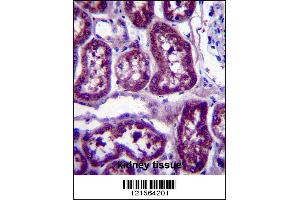 DPYS Antibody immunohistochemistry analysis in formalin fixed and paraffin embedded human kidney tissue followed by peroxidase conjugation of the secondary antibody and DAB staining. (DPYS antibody  (C-Term))