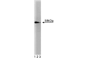 Western blot analysis of hHR23B on a A431 cell lysate (Human epithelial carcinoma, ATCC CRL-1555). (RAD23B antibody  (AA 73-193))
