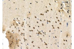 ABIN6263139 and ABIN6266820 at 1/100 staining Rat brain tissue by IHC-P. (MAST3 antibody  (Internal Region))