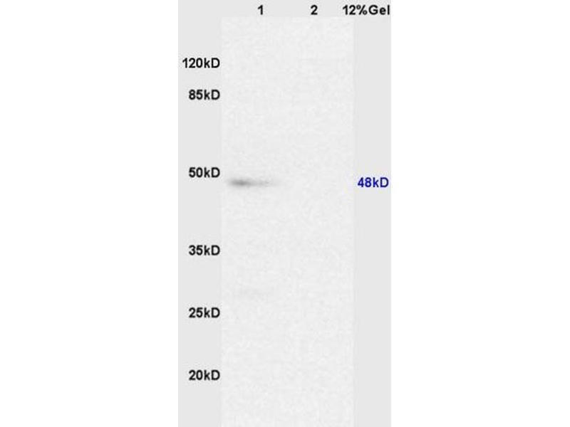 anti-Caspase 8 (CASP8) (AA 411-482) antibody