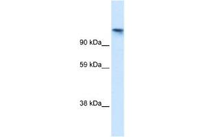 WB Suggested Anti-TIP120A Antibody Titration:  1. (CAND1 antibody  (N-Term))