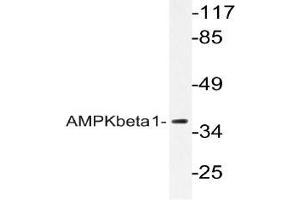 Western blot (WB) analyzes of AMPKbeta1 antibody in extracts from Jurkat cells. (PRKAB1 antibody)