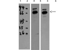 Western Blotting (WB) image for anti-Catalase (CAT) (C-Term) antibody (ABIN3187698)