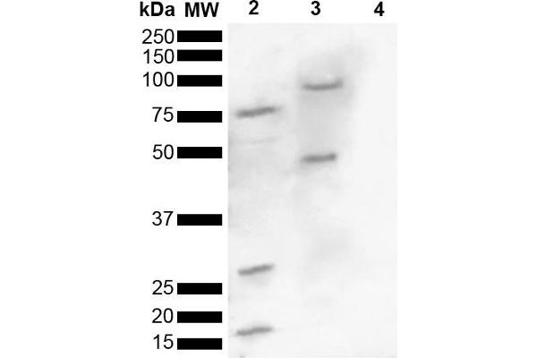 SNCA antibody  (pSer129)