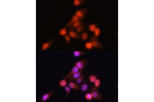 Immunofluorescence (IF) image for anti-Cyclin-Dependent Kinase Inhibitor 2A (Melanoma, P16, Inhibits CDK4) (CDKN2A) antibody (ABIN6139280)