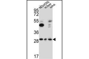 TAF1D Antibody (N-term) (ABIN651786 and ABIN2840399) western blot analysis in NCI-,Jurkat cell line and mouse liver lysates (15 μg/lane).