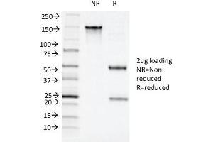 SDS-PAGE Analysis Purified CD11c Mouse Monoclonal Antibody (ITGAX/1243). (CD11c antibody  (AA 637-827))