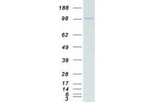 Western Blotting (WB) image for Microtubule Associated serine/threonine Kinase-Like (MASTL) protein (Myc-DYKDDDDK Tag) (ABIN2725544)