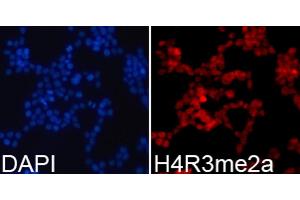 Immunofluorescence analysis of 293T cells using Asymmetric DiMethyl-Histone H4-R3 antibody (ABIN3016059, ABIN3016060, ABIN3016061, ABIN1680261 and ABIN6219537). (Histone H4 antibody  (2meArg3))