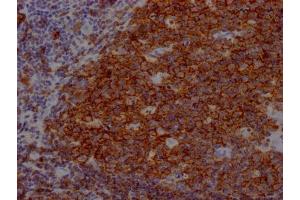 IHC image of ABIN7127396 diluted at 1:100 and staining in paraffin-embedded human tonsil tissue performed on a Leica BondTM system. (Recombinant CD19 antibody)