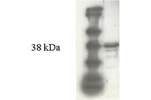Western Blot (10% PAGE) analysis of r-MTGase (Caldesmon antibody  (Isoform L))