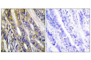 Immunohistochemistry (IHC) image for anti-Diacylglycerol Kinase, eta (DGKH) (Internal Region) antibody (ABIN1849746) (DGKH antibody  (Internal Region))