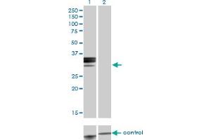 Western blot analysis of HPX over-expressed 293 cell line, cotransfected with HPX Validated Chimera RNAi (Lane 2) or non-transfected control (Lane 1). (Hemopexin antibody  (AA 1-254))