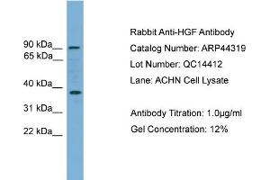 WB Suggested Anti-HGF  Antibody Titration: 0. (HGF antibody  (Middle Region))