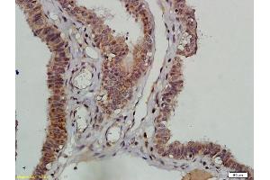 Formalin-fixed and paraffin embedded human ovarian tissue labeled with Anti-DNAPK/PRKDC Polyclonal Antibody, Unconjugated (ABIN685417) followed by conjugation to the secondary antibody and DAB staining (PRKDC antibody  (AA 151-300))