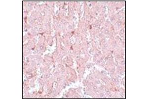 Immunohistochemistry of LXR-A in rat liver tissue with this product at 5 μg/ml. (NR1H3 antibody  (N-Term))
