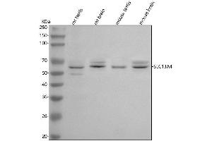 anti-Solute Carrier Family 13 Member 4 (SLC13A4) (AA 150-626) antibody