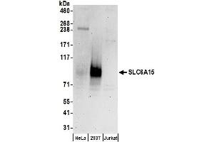 anti-Solute Carrier Family 6 (Neutral Amino Acid Transporter), Member 15 (SLC6A15) (AA 653-703) antibody