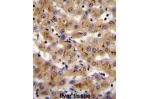 CSAD Antibody (Center) immunohistochemistry analysis in formalin fixed and paraffin embedded human liver tissue followed by peroxidase conjugation of the secondary antibody and DAB staining. (CSAD antibody  (Middle Region))