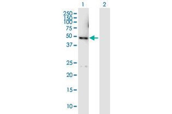 DYX1C1 Antikörper  (AA 1-381)