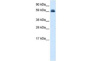 Western Blot showing ZNF499 antibody used at a concentration of 1-2 ug/ml to detect its target protein. (ZBTB45 antibody  (Middle Region))