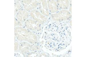 Immunohistochemistry of paraffin-embedded Human kidney (negative control sample) using CD79a antibody (ABIN7265805) at dilution of 1:100 (40x lens). (CD79a antibody)