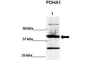 WB Suggested Anti-PDHA1 Antibody    Positive Control:  Lane 1: 60ug human NT2 cell line   Primary Antibody Dilution :   1:500  Secondary Antibody :  IRDye 800 CW goat anti-rabbit from Li-COR Bioscience  Secondry Antibody Dilution :   1:20,000  Submitted by:  Dr. (PDHA1 antibody  (C-Term))