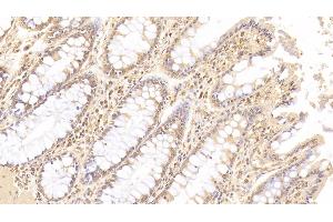 Detection of ANGPT1 in Human Colon Tissue using Monoclonal Antibody to Angiopoietin 1 (ANGPT1) (Angiopoietin 1 antibody  (AA 284-452))