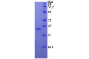 SDS-PAGE of Protein Standard from the Kit (Highly purified E. (BMP4 ELISA Kit)
