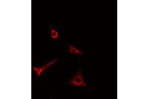 ABIN6269299 staining Hela cells by IF/ICC. (ADAM17 antibody  (C-Term))