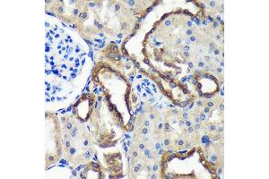 Immunohistochemistry of paraffin-embedded Rat kidney using C18orf8 Rabbit pAb (ABIN7266379) at dilution of 1:100 (40x lens). (C18orf8 antibody  (AA 1-300))