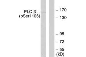 Western blot analysis of extracts from A431 cells, using PLCB3 (Phospho-Ser1105) Antibody. (PLCB3 antibody  (pSer1105))